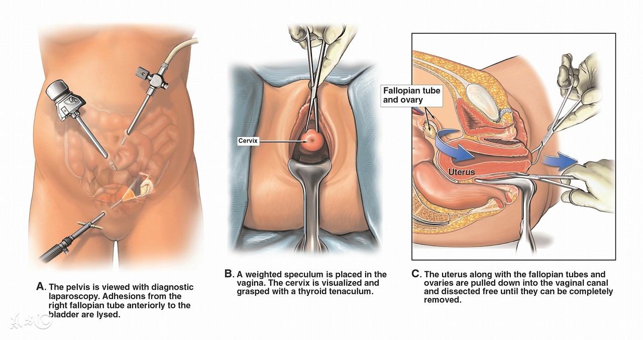 为什么有些人怀孕这么难,怀孕困难是命中注定吗