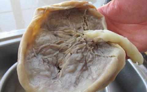 胎盘如何处置对宝宝好,胎盘怎么处置对孩子大人好