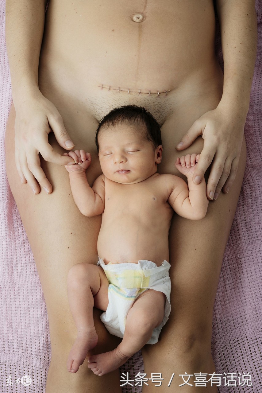 剖宫产对子宫损伤大,剖宫产会不会损伤子宫内膜