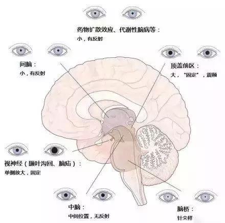 绘制神经系统的生理解剖图,人体骨骼血管神经系统解剖图