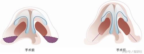 甜美少女养成,甜美养成记学生党