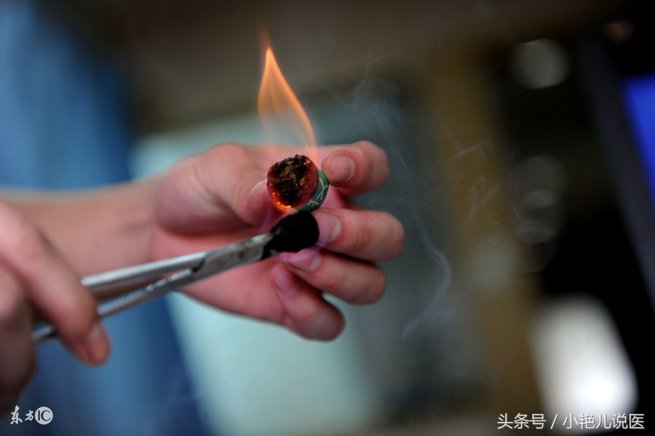 民间放血治病,放血有效吗