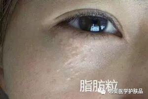 鑸掑┓绁涚棙,鑸掑┓鎶よ偆