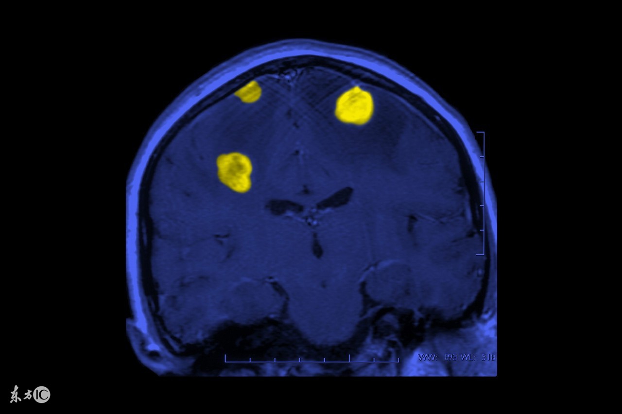 护理新生儿缺血缺氧性脑病的方法有哪些