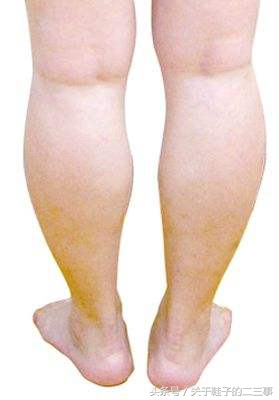 腿型不直适合穿什么款型靴子,155腿粗o型腿穿什么靴子