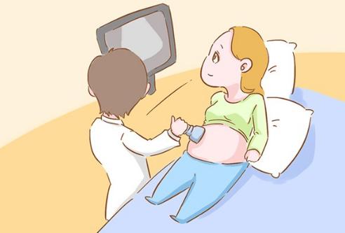 做四维的时候宝宝居然笑了,四维一遍过宝宝是聪明还是不聪明