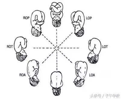生孩子胎位不正推肚子矫正胎位,纠正胎位的姿势有哪些