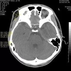 财团到底是什么东西,ct到底对人体有多危害
