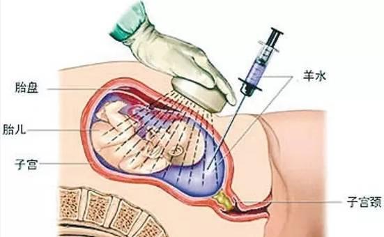 准妈妈必看孕期知识,唐氏筛查最全知识