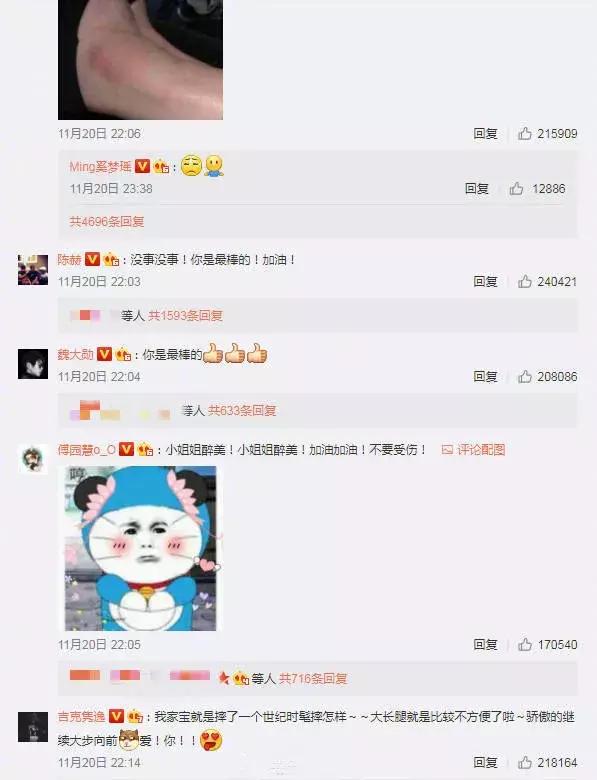 奚梦瑶摔跤对他造成的影响有多大,奚梦瑶维密大秀摔跤