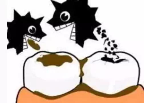 宝宝乳牙龋齿严重用拔牙不,孩子乳牙龋齿有必要补牙吗