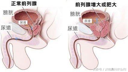 三甲医院通用的《疾病先兆自查表》，我用了几十年，现在还在用！