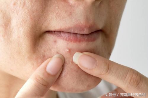 三甲医院通用的《疾病先兆自查表》,我用了几十年,现在还在用!