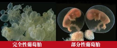 为什么怀孕了检查出来这么多问题,为啥怀孕了还要看指标