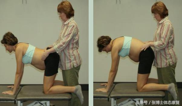 孕妇耻骨痛怎么锻炼,孕期耻骨疼多锻炼可以缓解吗