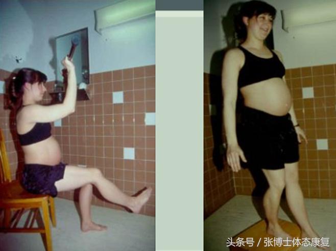 孕妇耻骨痛怎么锻炼,孕期耻骨疼多锻炼可以缓解吗