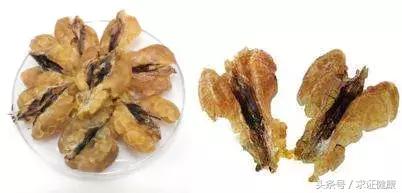 怀孕为啥长子宫肌瘤,年纪轻轻为什么有子宫肌瘤