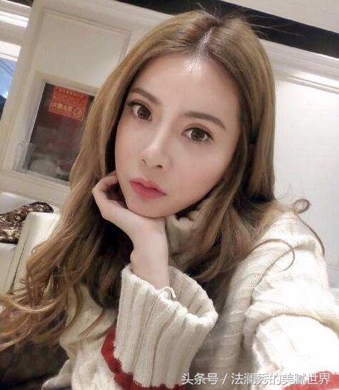 祛斑成功堪比整容,激光祛斑显老