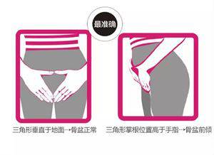 怎么判断是不是骨盆前倾矫正方法,矫正骨盆前倾的睡觉姿势