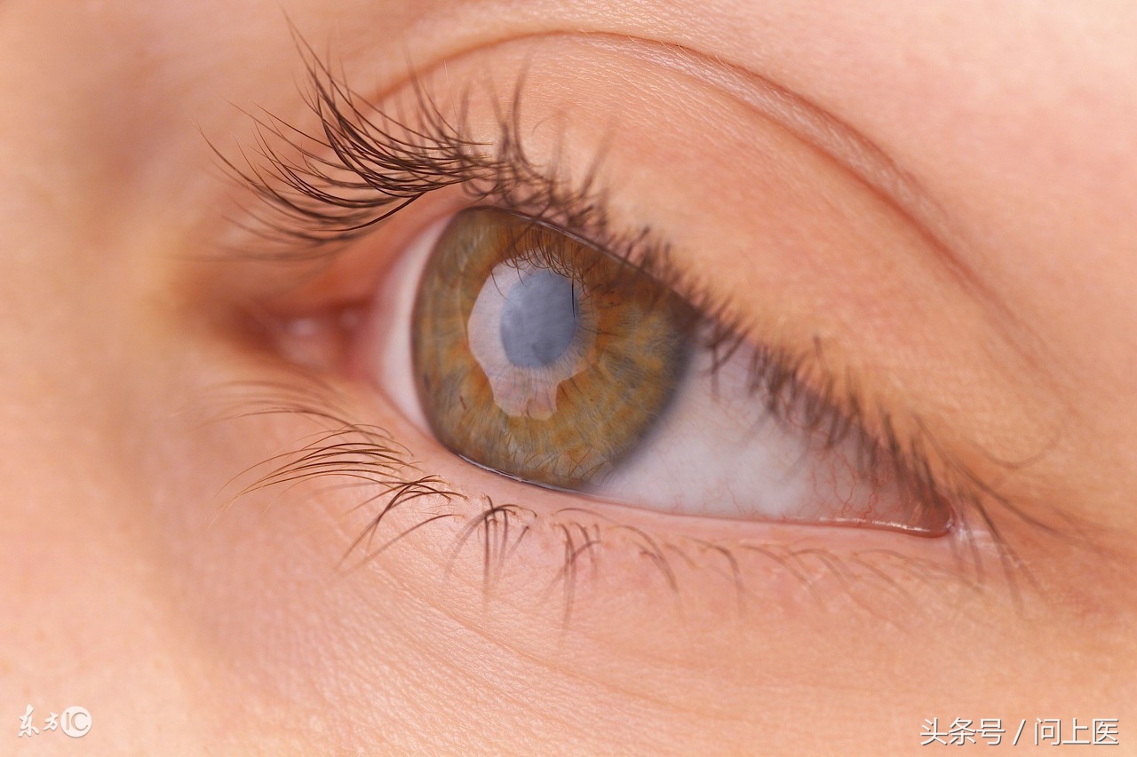 类风湿关节炎累及眼睛怎么治疗,类风湿性关节炎与眼部的并发症