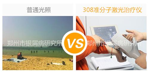 银屑病最好的治疗方法,红皮病型银屑病治疗最好方法