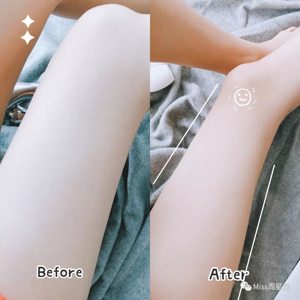 wellbox美容仪,wellbox美容仪用法