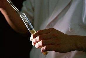 24小时尿蛋白定量留尿注意事项,24小时尿蛋白定量前注意事项