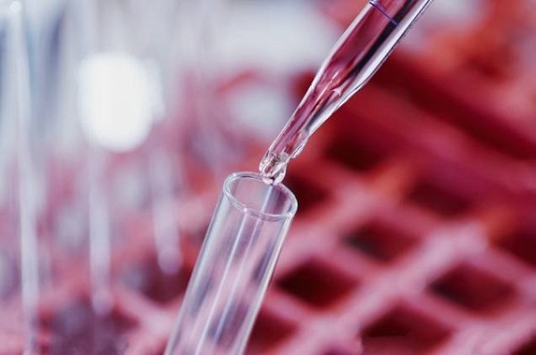 艾滋病并非不治之症？“洗精术”到底是什么