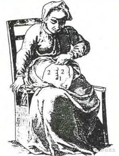 精品原创︱医生，您为什么要让我“挂粪袋”？