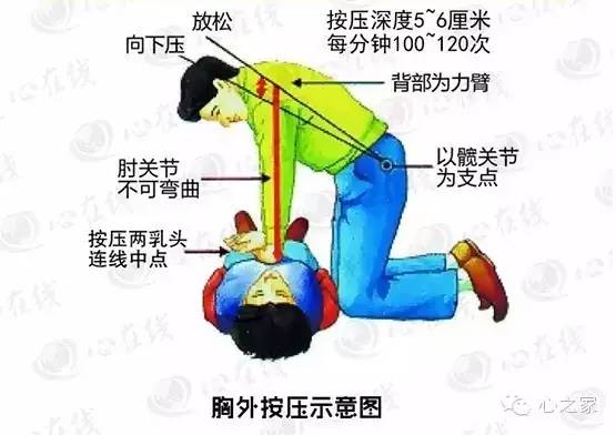 心脏救援怎么救,心脏紧急施救方法