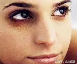 有效消除眼部浮肿的简单护理方法,如何化妆消除肿泡眼