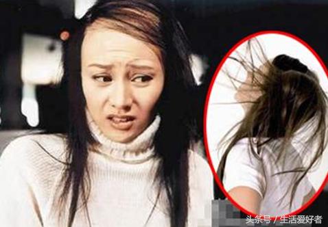 没有遗传基因脱发会秃头吗,遗传脱发基因到底有多可怕