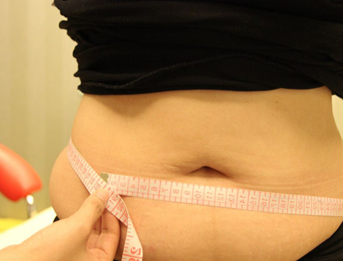 剖腹产比顺产好？对于顺产的这几个误解，你也有吗？