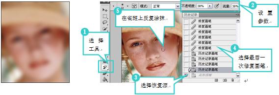 磨皮式祛斑的方法,磨皮祛斑操作流程