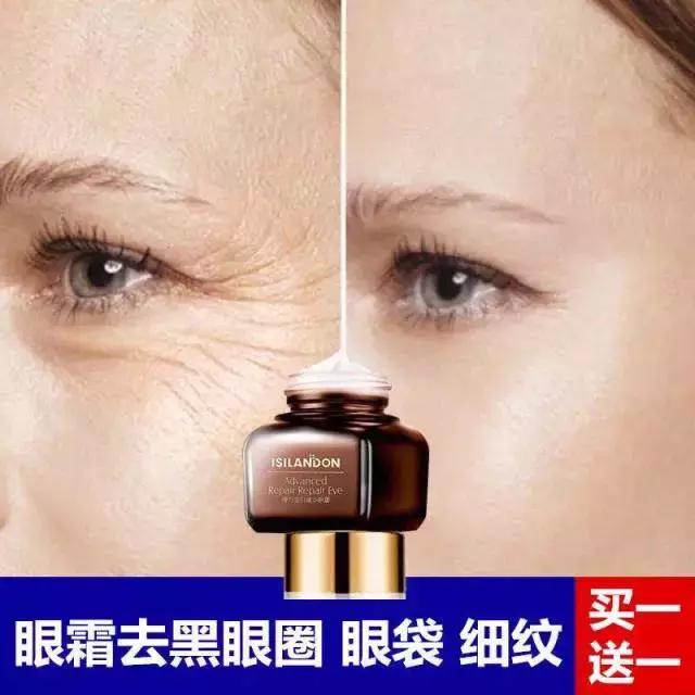 眼霜治眼袋有效吗,解决眼部问题的眼霜