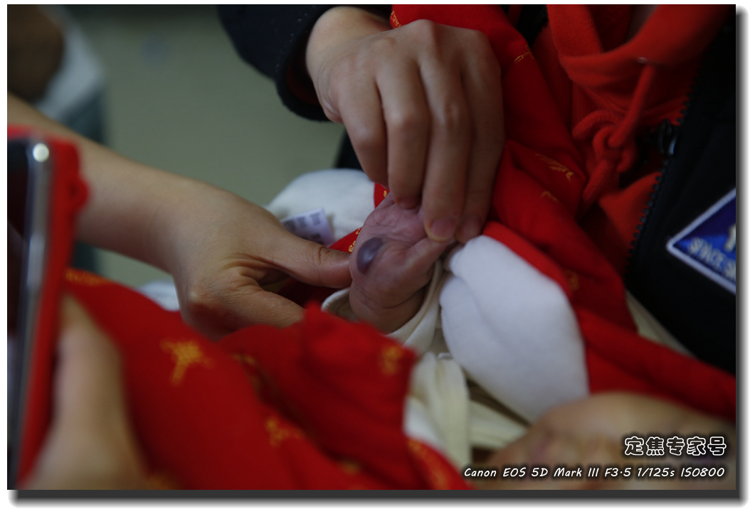 皮肤专家诊室故事连载之五,手心和眉心“开天眼”?