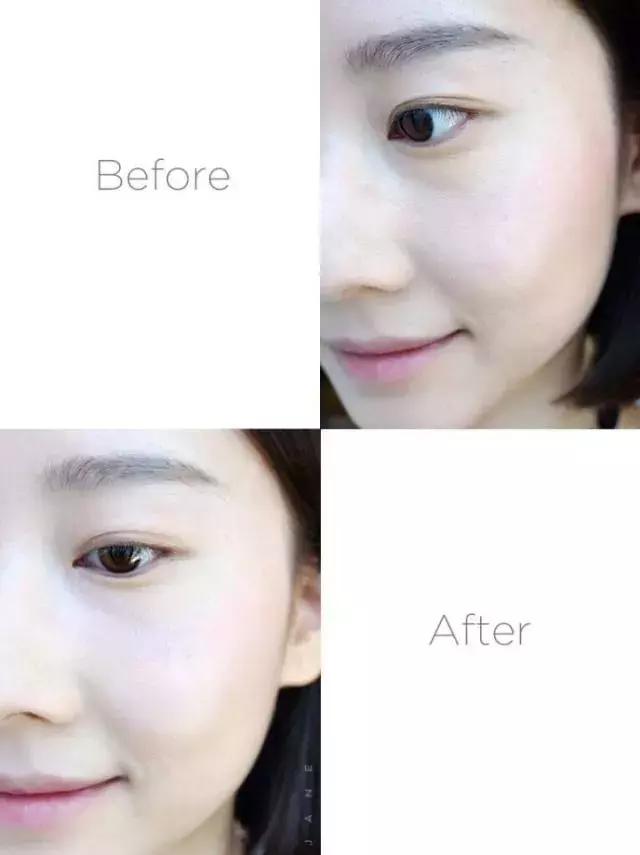 比打玻尿酸还有效！把省下的钱都做这个