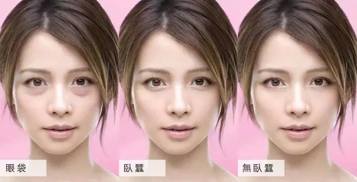 27岁有细纹黑眼圈用什么眼部护理,黑眼圈细纹浮肿补水