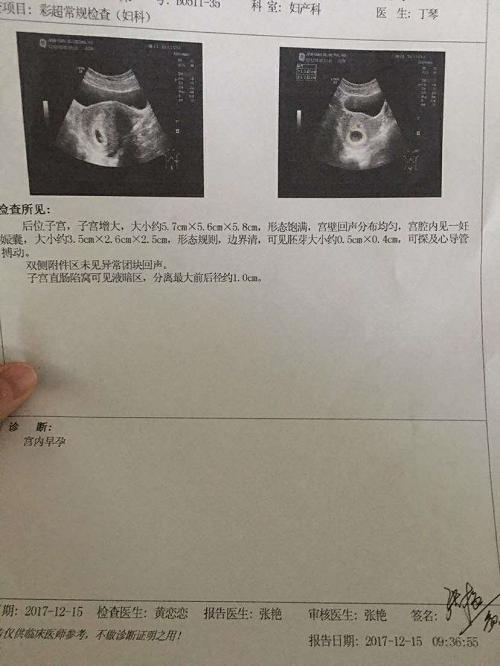 多囊好孕经验5月16号排卵,多囊顽固体质能怀孕吗