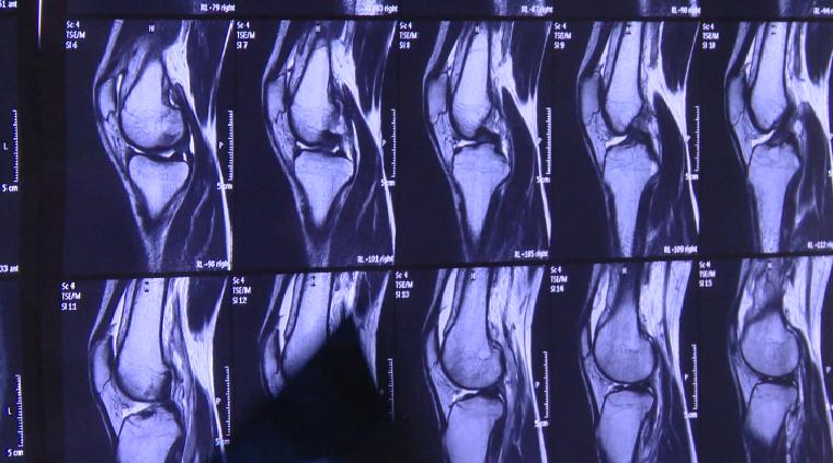 每天健步走10000步会长胖吗,每天健身走多少路最适宜