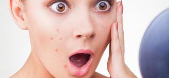 铦舵浮闈㈤儴鎶ょ悊,铦舵浮淇鍑濊兌