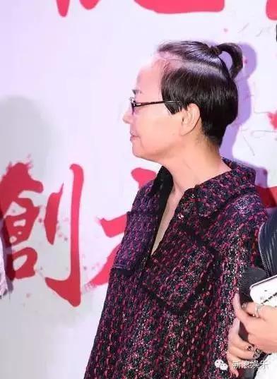 宋丹丹刘海发际线,宋丹丹真的植发吗