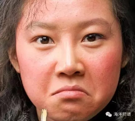 皮肤红痒刺痛用什么药膏,皮肤红刺痛