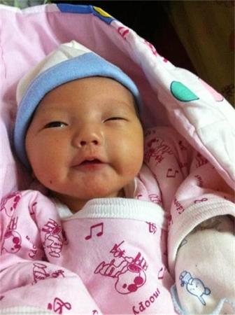 新生儿黄疸的类型及处理方法,新生儿黄疸不用慌消退黄疸有妙招