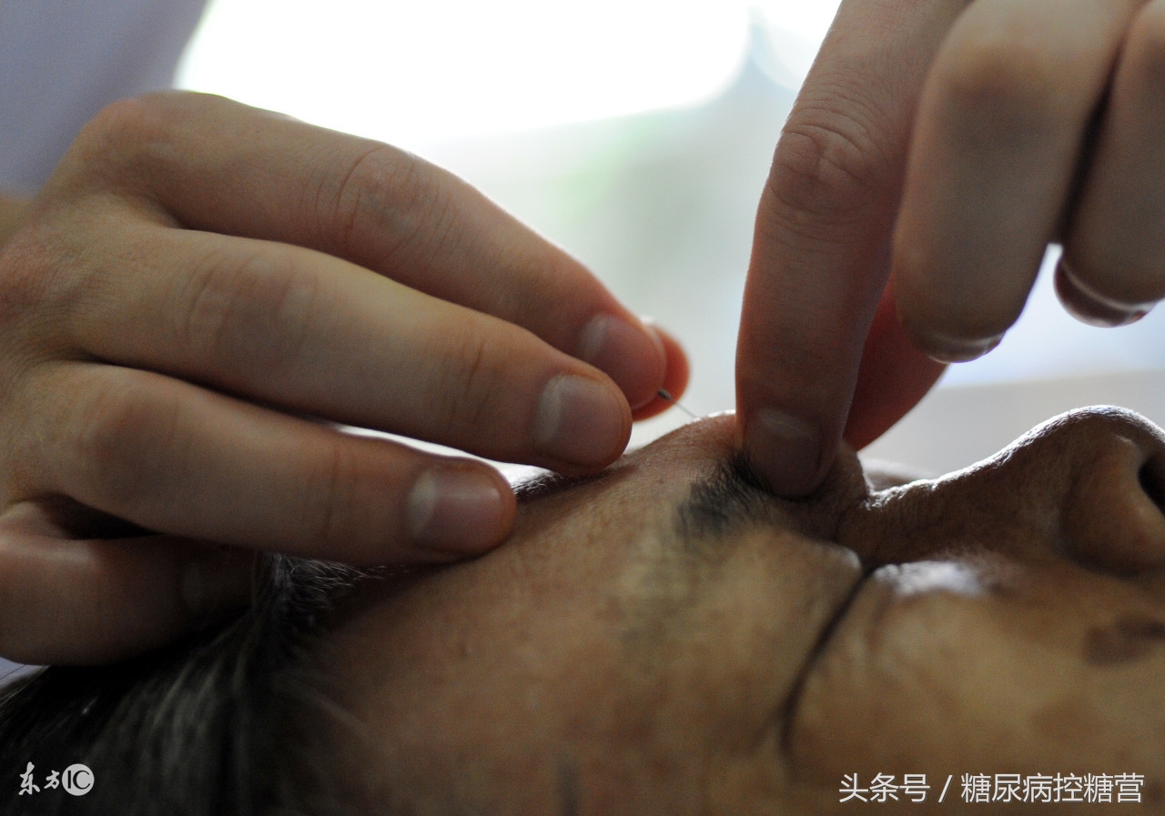 中医糖尿病并发症,中国中医治疗糖尿病的最好医生