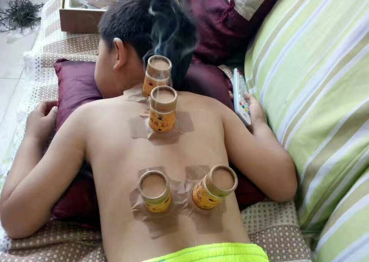 艾宝贝的健康养生,不用抗生素的艾灸方法