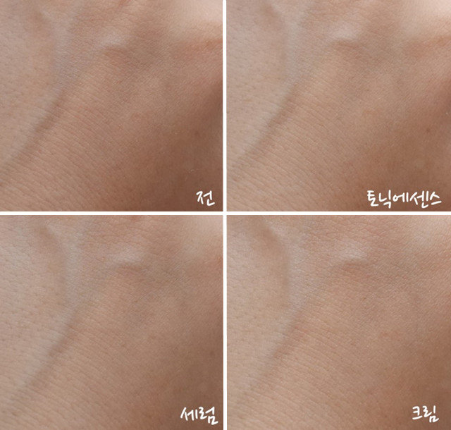 快速祛痘印小技巧,小妙招帮你祛痘印视频