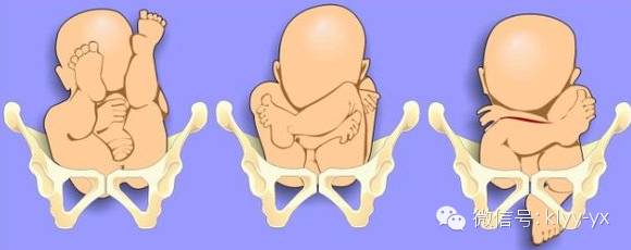 分娩前一定要知道的9件事,分娩前必知的准备事项