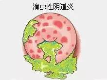 孕妈感觉肚脐周围疼怎么回事,孕妈感到身体难受