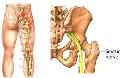 准妈妈总是臀疼腰疼怎么回事,肚子疼有阑尾炎病史怎么有效缓解